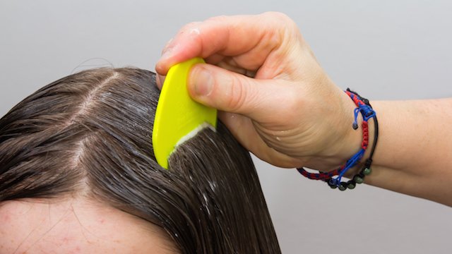 До чого сняться блохи: Чекати радості чи смутку?