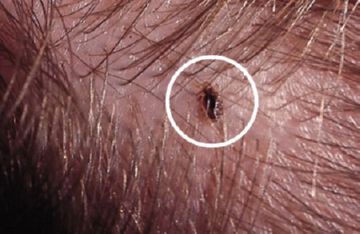 Домашні паразити комахи: їх особливості та методи боротьби