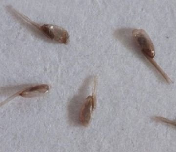 Гниди і довге волосся: вирішення проблеми і заходи профілактики