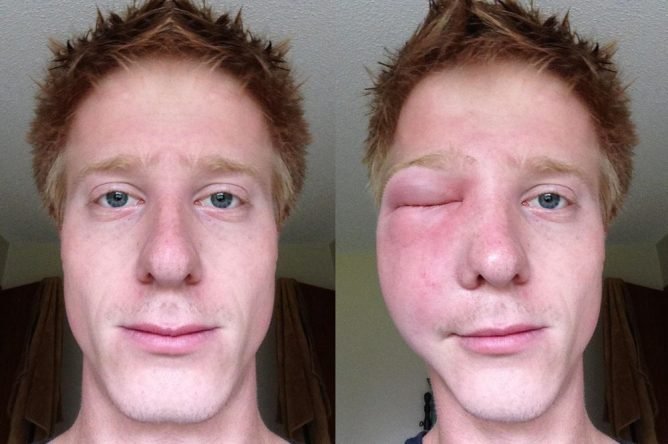 Як позбутися від ос в будинку і на дачі