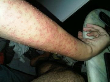 Вогненні мурахи – мисливці на кайманів