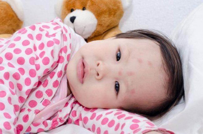 Як виглядає укус кліщів, змій, бліх та інших тварин: проінформований — значить обезопасен