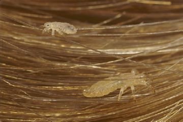 Бензилбензоат   лікування педикульозу без особливих витрат