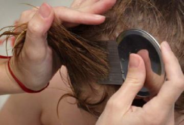 Засоби від вошей і гнид: огляд, ціни