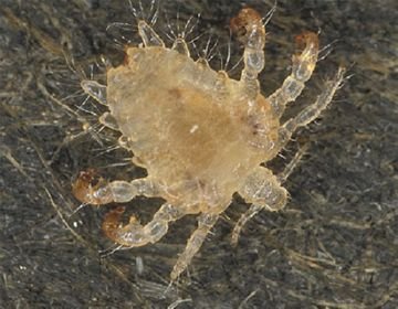 Які різновиди вошей можуть зявитися у людини