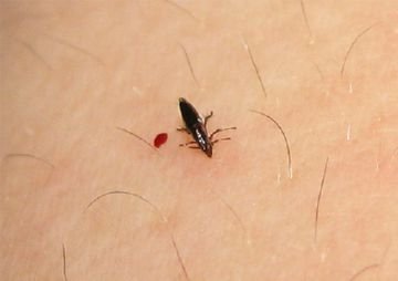 Як блохи різних видів кусають людину