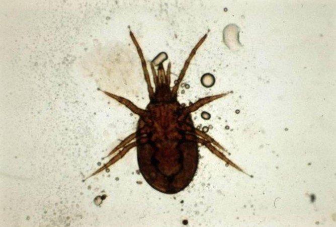 Гамазовые кліщі та їх відмінні особливості