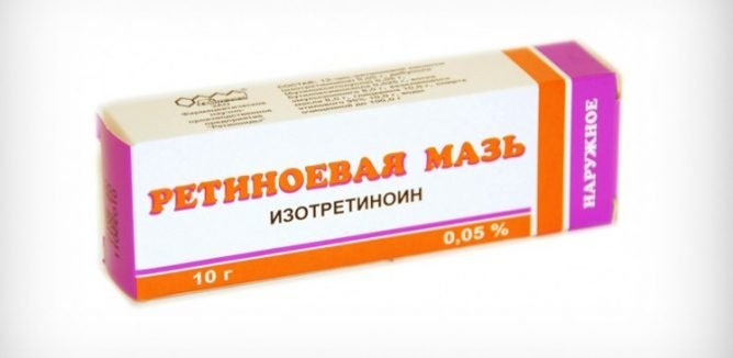 Лікування демодекозу на обличчі: як позбутися від особового кліща