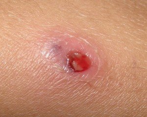 Чим небезпечні таргани: кусаються чи, може тарган залізти в вухо