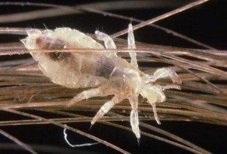 Вошей на голові: зовнішній вигляд, симптоми та шляхи зараження