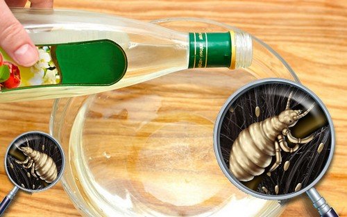 Народні засоби від вошей – правила використання
