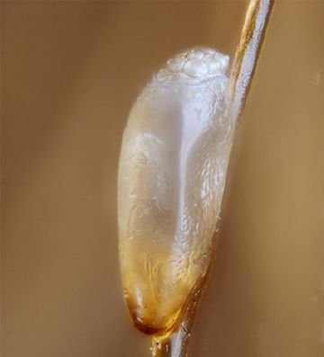 Як вивести вошей і гнид за допомогою гасу