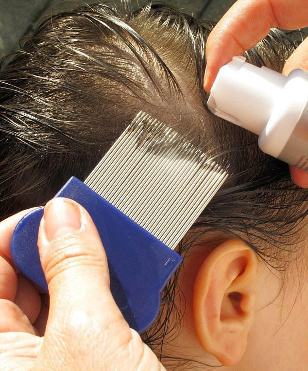 Можуть воші переносити небезпечні хвороби — способи позбавлення від паразитів