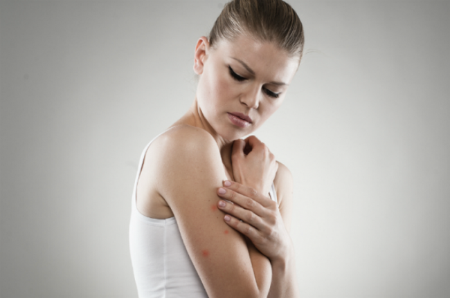 Блохи у людини — народні і хімічні засоби боротьби