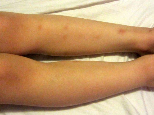 Як виглядають клопи !? Де живуть і чим харчуються !?