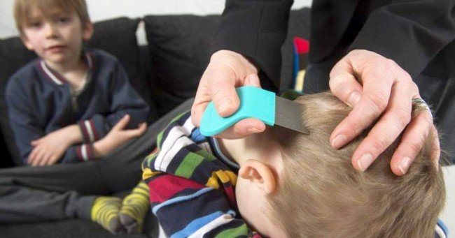 Гниди у дитини: чим небезпечні і як швидко лікувати !?
