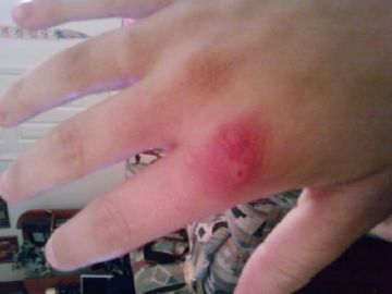 Каракурт: середовище, небезпека для людини і цікаві факти Каракурт: середовище, небезпека для людини і цікаві факти