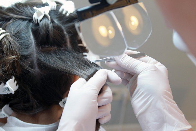 Воші і гниди у дітей — Ефективні поради для батьків