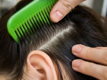 Як швидко вбити вошей і гнид за допомогою різних засобів