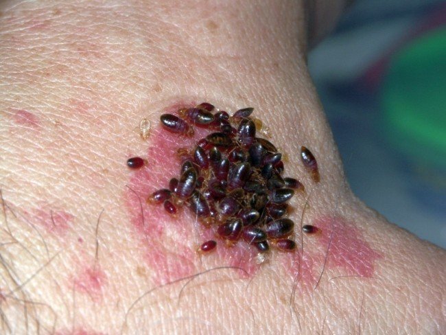 Як вивести клопів у квартирі: дезінсекція або народні методи?