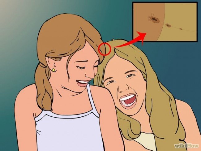 Воші і гниди у дітей — Ефективні поради для батьків