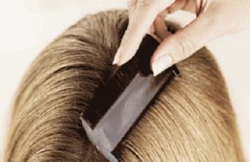 Які симптоми свідчать про зараження вошами: головними, білизняними, лобковими