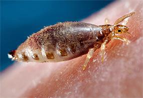 Чим харчуються воші – спосіб життя і особливості