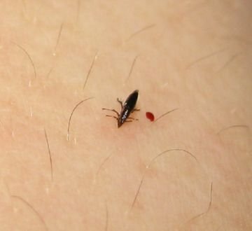 Чим лікувати укуси котячих, собачих і земляних бліх у людини