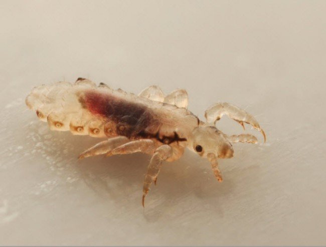 Головна воша — звідки береться і як позбутися !?