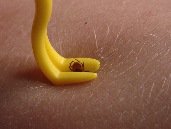 Укус кліща: як витягнути і що робити далі