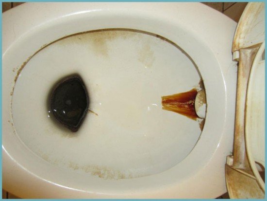 Як очистити унітаз від вапняного нальоту і сечового каменю