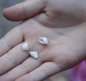 Сонник Випадання Зубів до чого сниться Випадання Зубів з кровю, болем і без бачити уві сні
