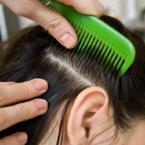 Сонник воші, до чого сняться Воші бачити уві сні