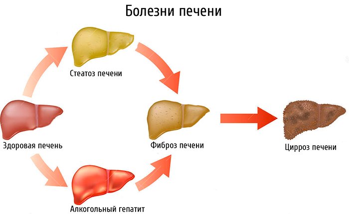 З якого боку і де знаходиться печінка у людини (фото), які симптоми при цирозі печінки і як болить