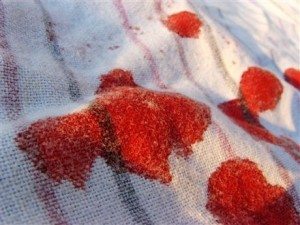 Сонник багато Крові до чого сниться багато чужої Крові бачити уві сні