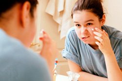 Сонник Тиснути Прищі: на лобі, носі, особі бачити уві сні до чого сниться