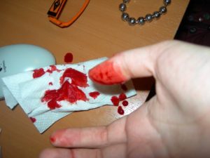 Сонник Порізати Палець до крові уві сні склом бачити до чого сниться?