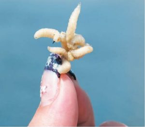 Сонник Опариші білі на тілі людини і напів у сні бачити до чого сняться?