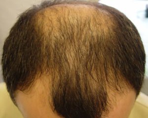 Сонник Бачити Себе Лисій уві Сні до чого сниться?