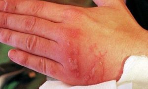 Сонник Людина, що Горить у вогні у сні бачити до чого сниться?