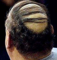 Сонник Бачити Себе Лисій уві Сні до чого сниться?