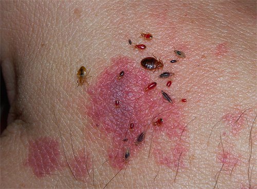 Домашній постільний клоп: фото, чим небезпечний і методи боротьби Домашній постільний клоп: фото, чим небезпечний і методи боротьби