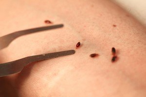 При якій температурі гинуть клопи і личинки