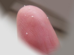 Земляні блохи фото, укуси і як позбутися народними засобами