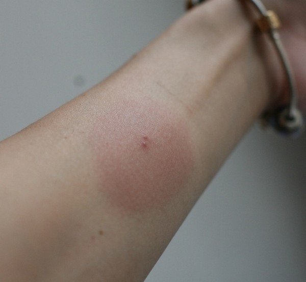 Чим небезпечна двухвостка: правда і міфи