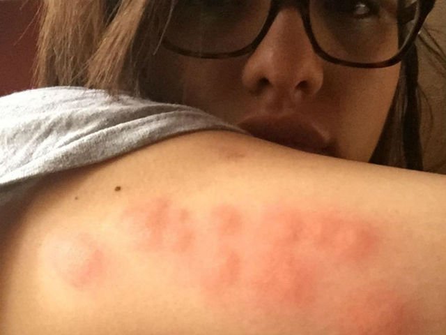 До чого сняться клопи уві сні   в квартирі, в ліжку, сонник