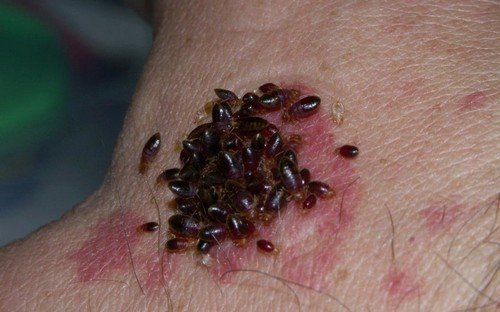 Розмноження клопів постільних в квартирі: терміни розвитку клопа