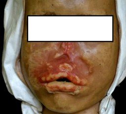 Чим небезпечні клопи для людини в квартирі: фото постільних