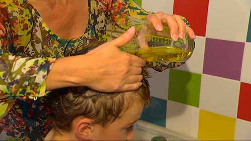 Воші у дитини   що робити, як лікувати в домашніх умовах