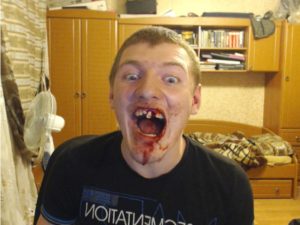 Сонник Вставні Щелепи у сні бачити до чого сняться?